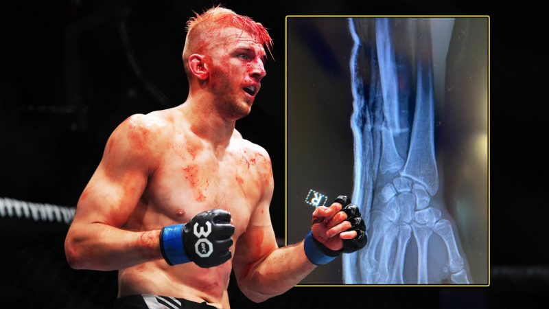 ‘Just a scratch’: Kiwi UFC legend Dan Hooker breaks arm during his tough UFC 290 fight